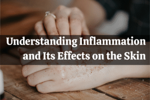 Understanding Inflammation and Its Effects on the Skin